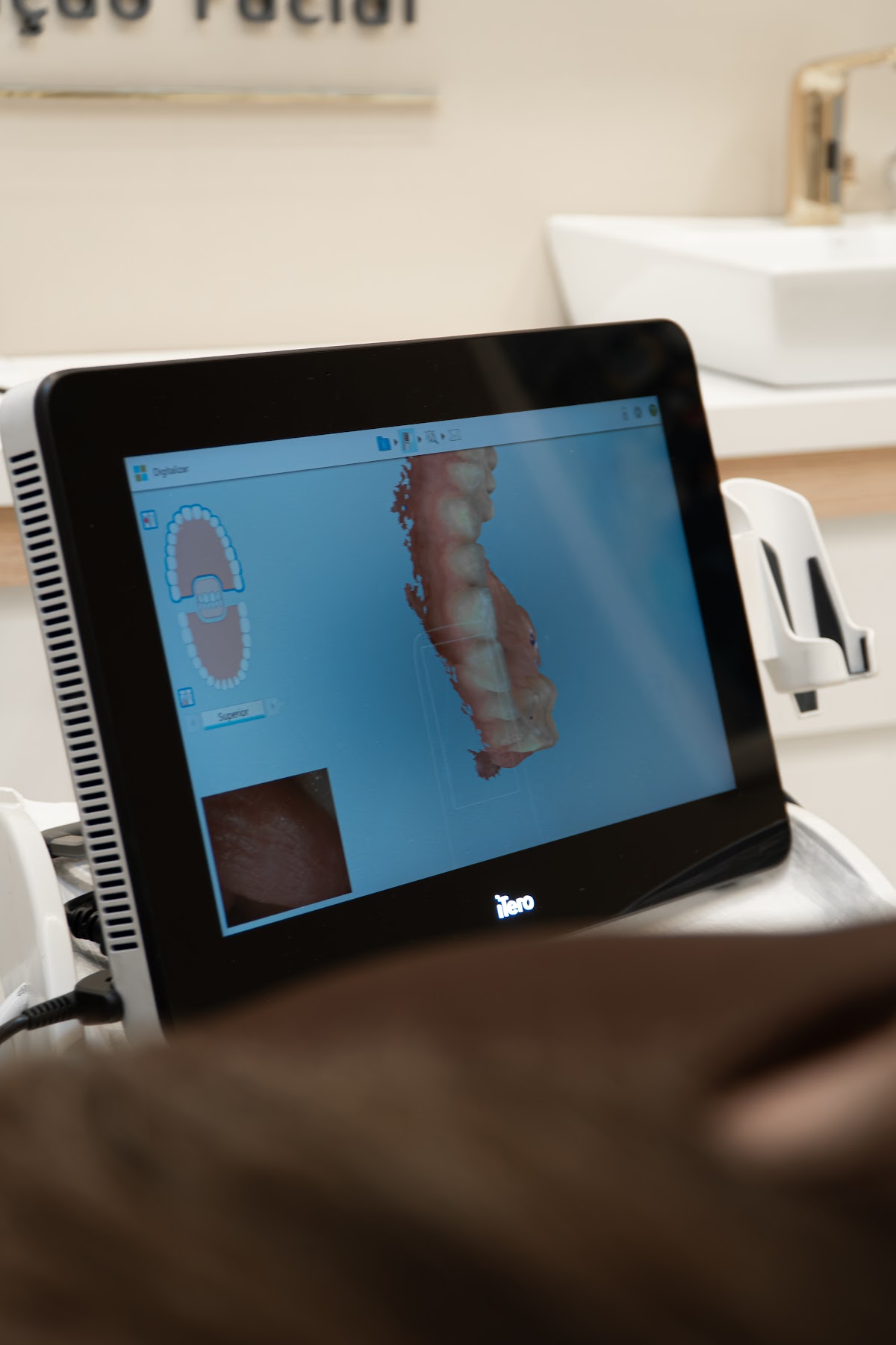Escaneamento digital intraoral com scanner iTero na Clínica Huk