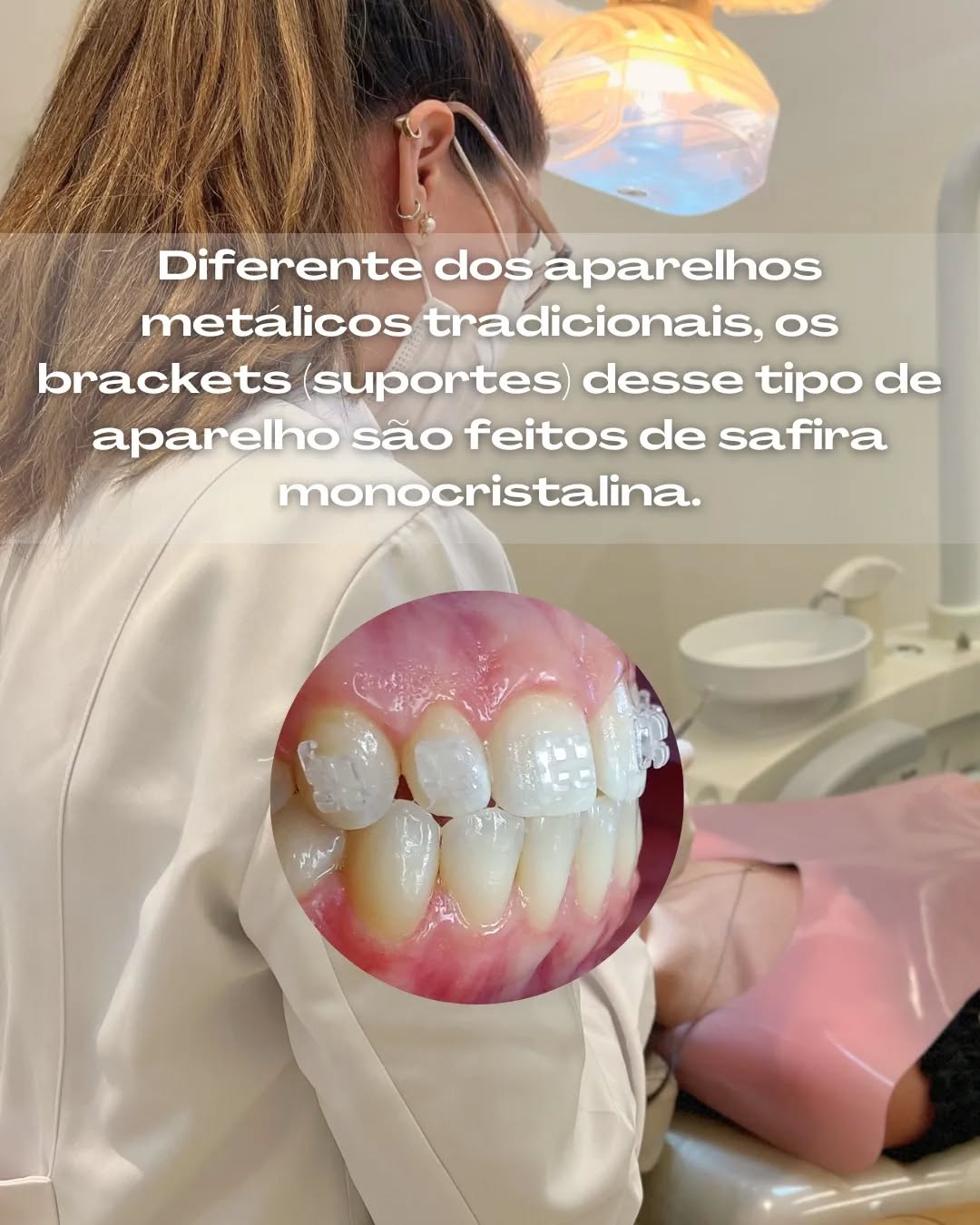 Braquetes de safira monocristalina