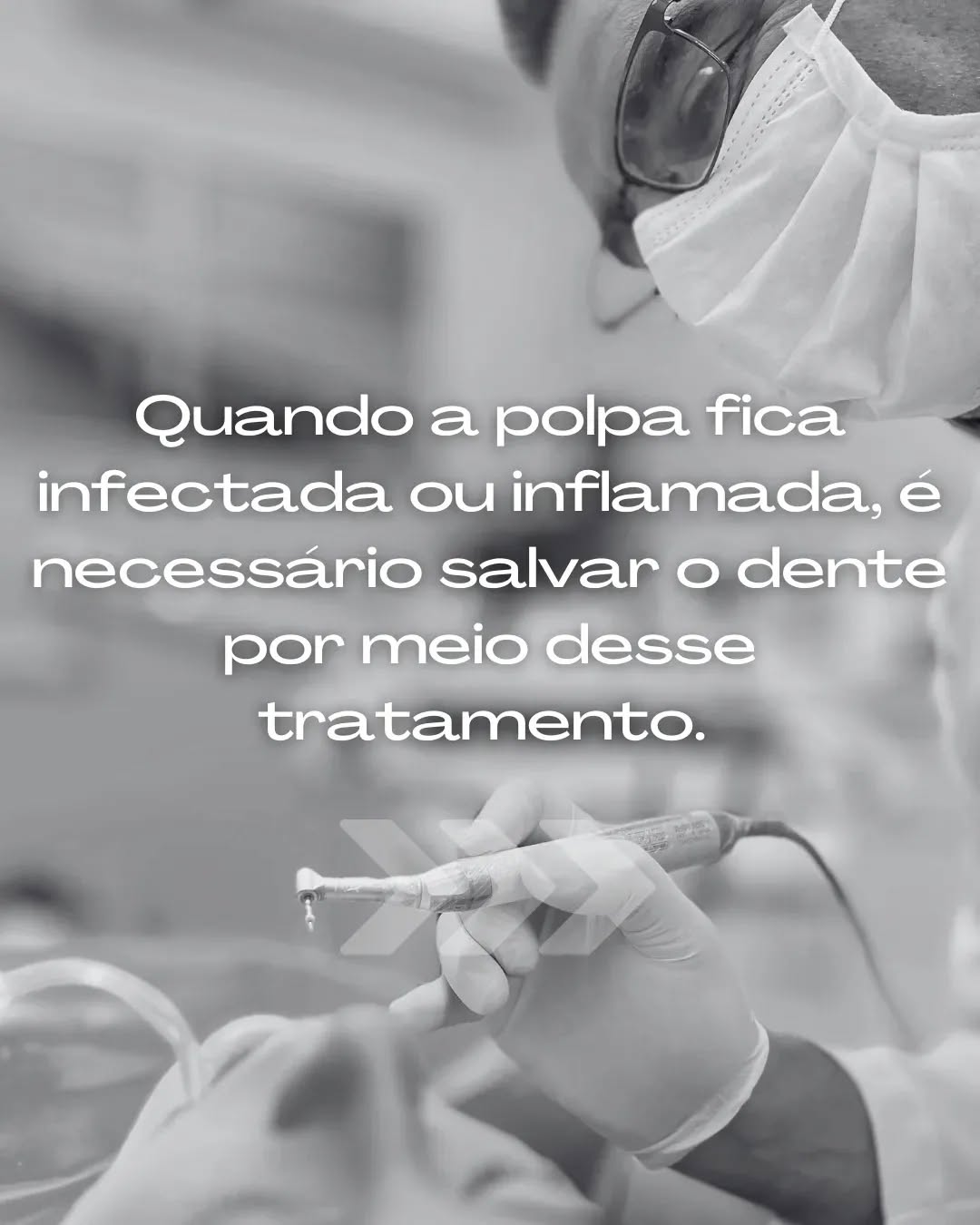 Quando a polpa fica infectada ou inflamada, o tratamento de canal salva o dente