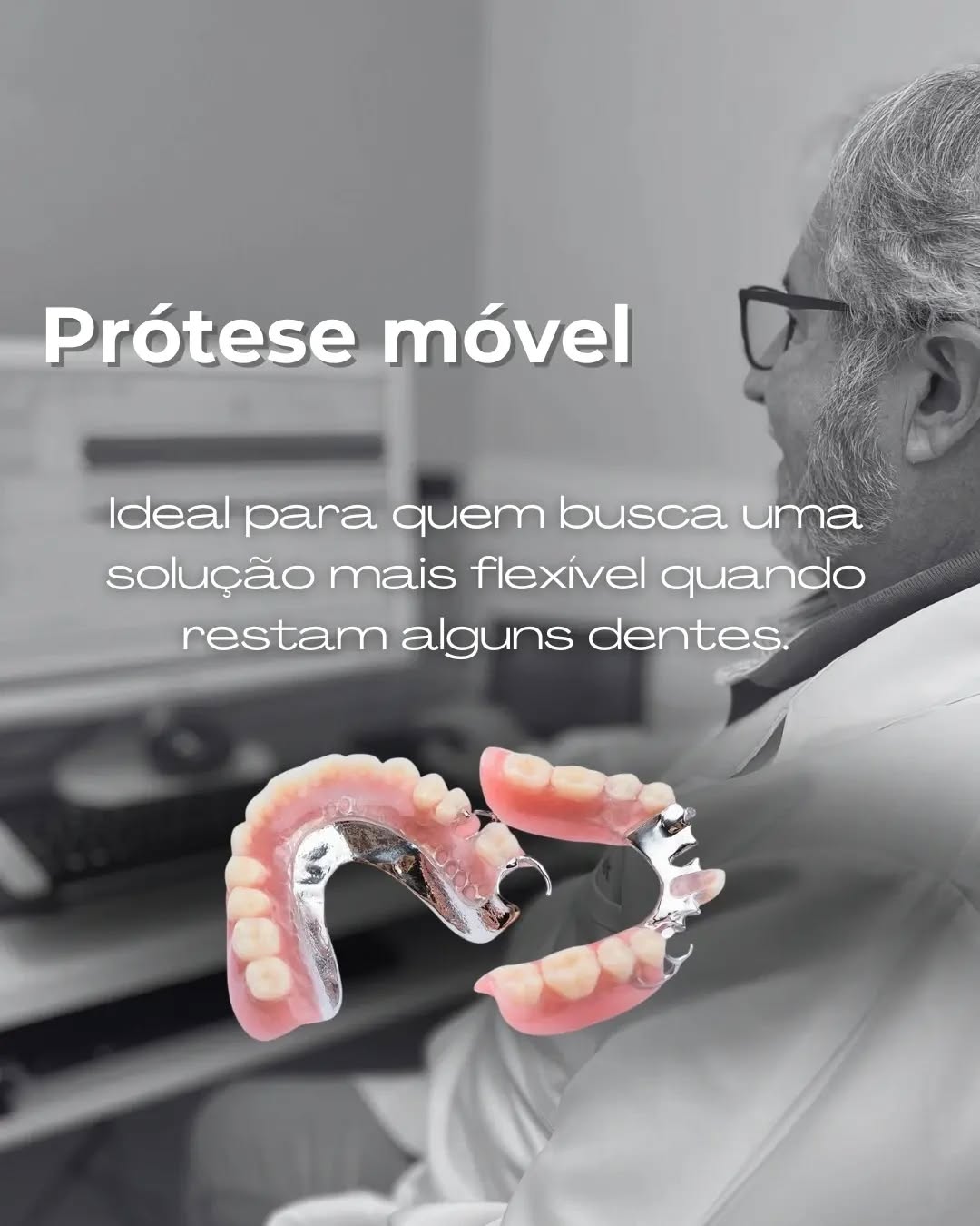 Prótese móvel, indicada quando restam alguns dentes