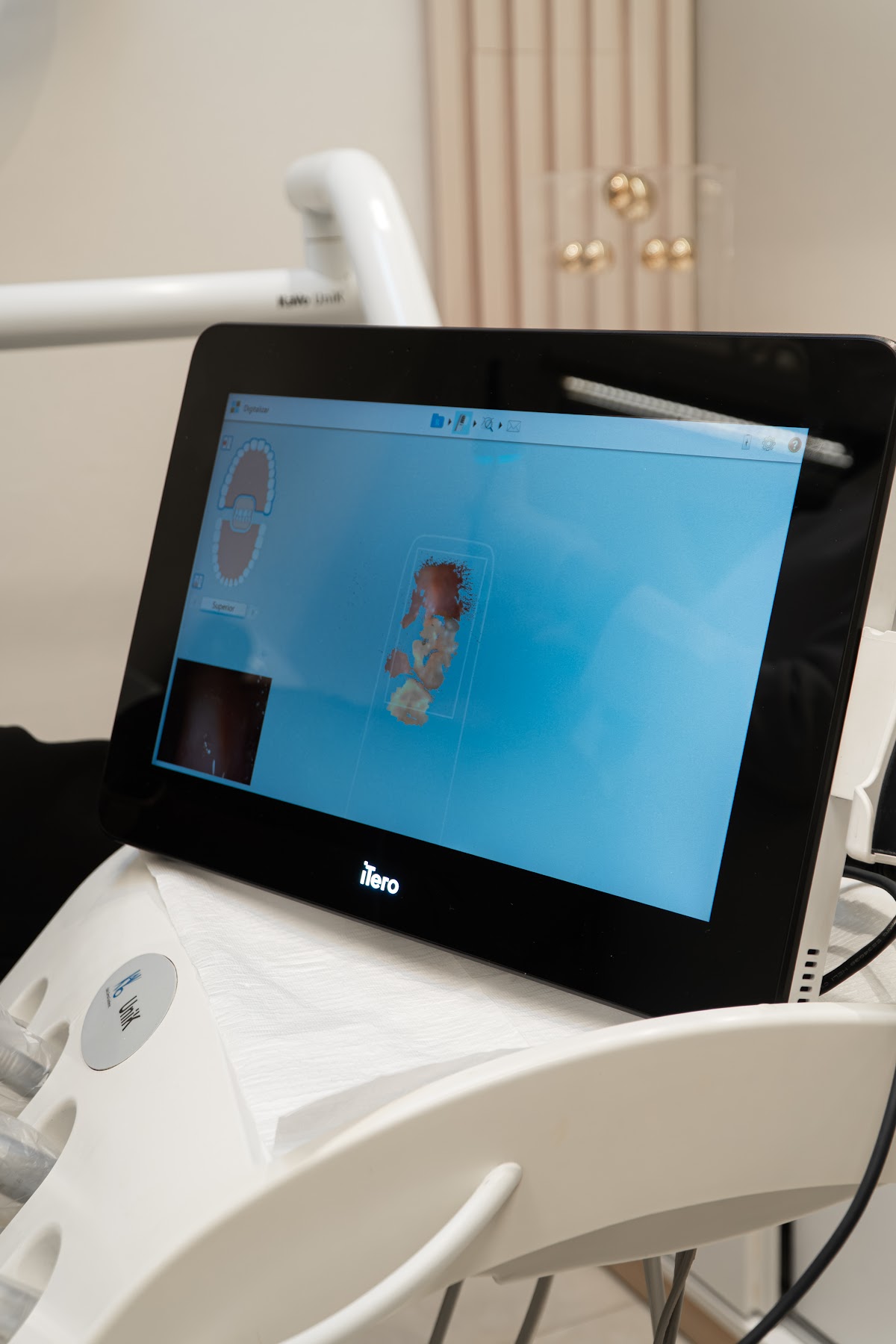 Tela do scanner iTero com modelo digital dos dentes