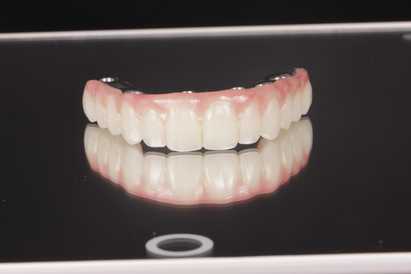Prótese tipo protocolo sobre implantes produzida na Clínica Huk