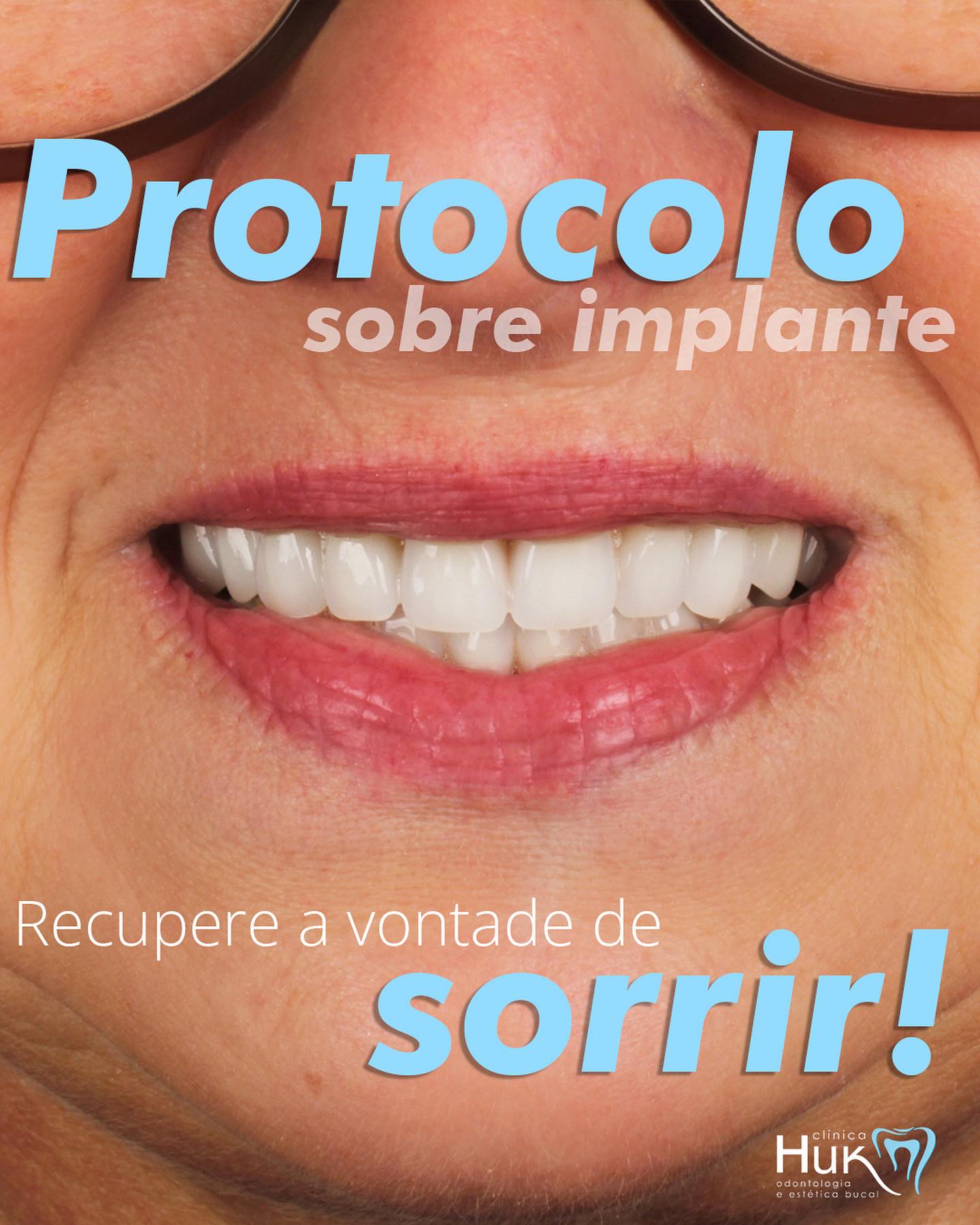 Paciente com prótese protocolo