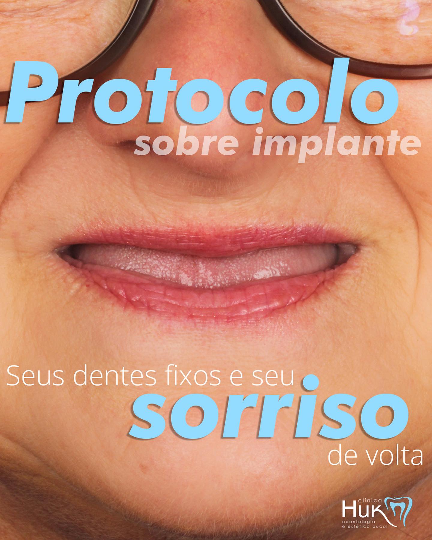 Paciente com prótese protocolo